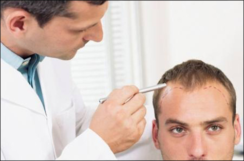 如何治療禿頭？別聽信網路謠言，先找出掉髮原因才能對症下藥！
